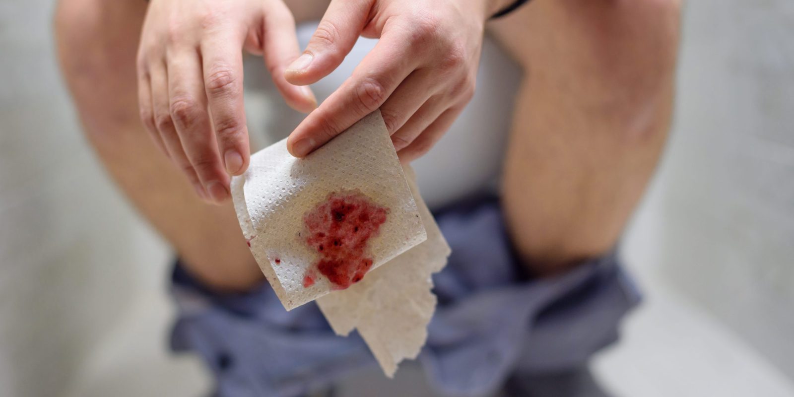 Tests Used to Diagnose Blood in Stools Your Health Lifestyle