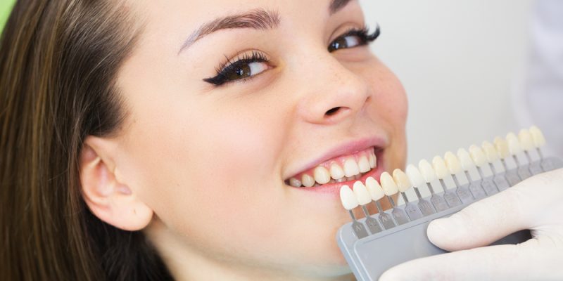 The Benefits and Drawbacks of Cosmetic Dentistry Procedures