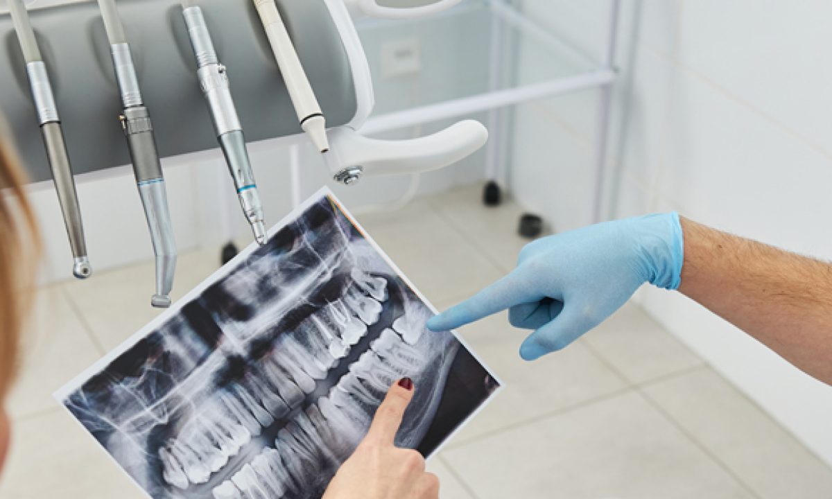 Dental Xrays' Value in Making an Accurate Diagnosis Your Health Lifestyle